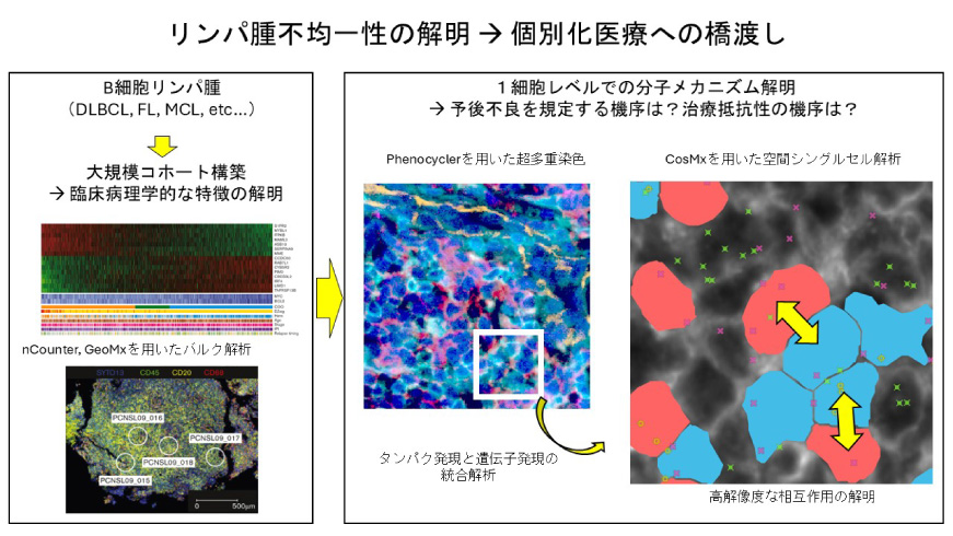 リンパ腫研究