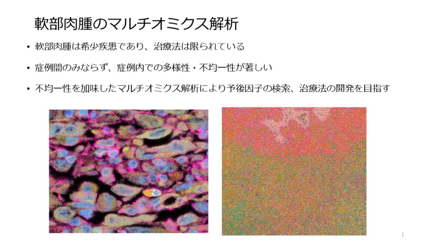 軟部肉腫研究